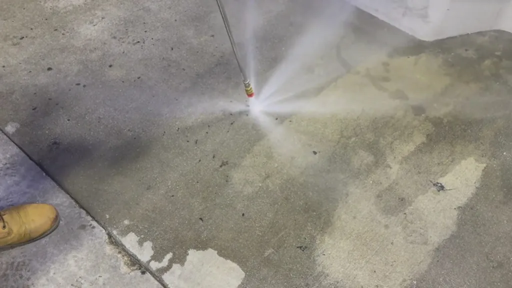 gum removal